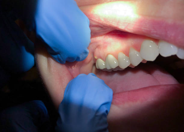 Best Emergency Dentist for Special Needs Patients in Lansdowne, VA